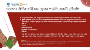 হাড় স্থাপন